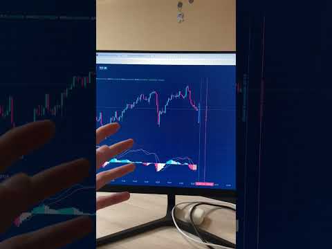 Готовая СВЯЗКА для новичков в ТРЕЙДИНГЕ! Заработок на Бинарных Опционах Готовая СВЯЗКА для новичков в ТРЕЙДИНГЕ! Заработок на Бинарных Опционах